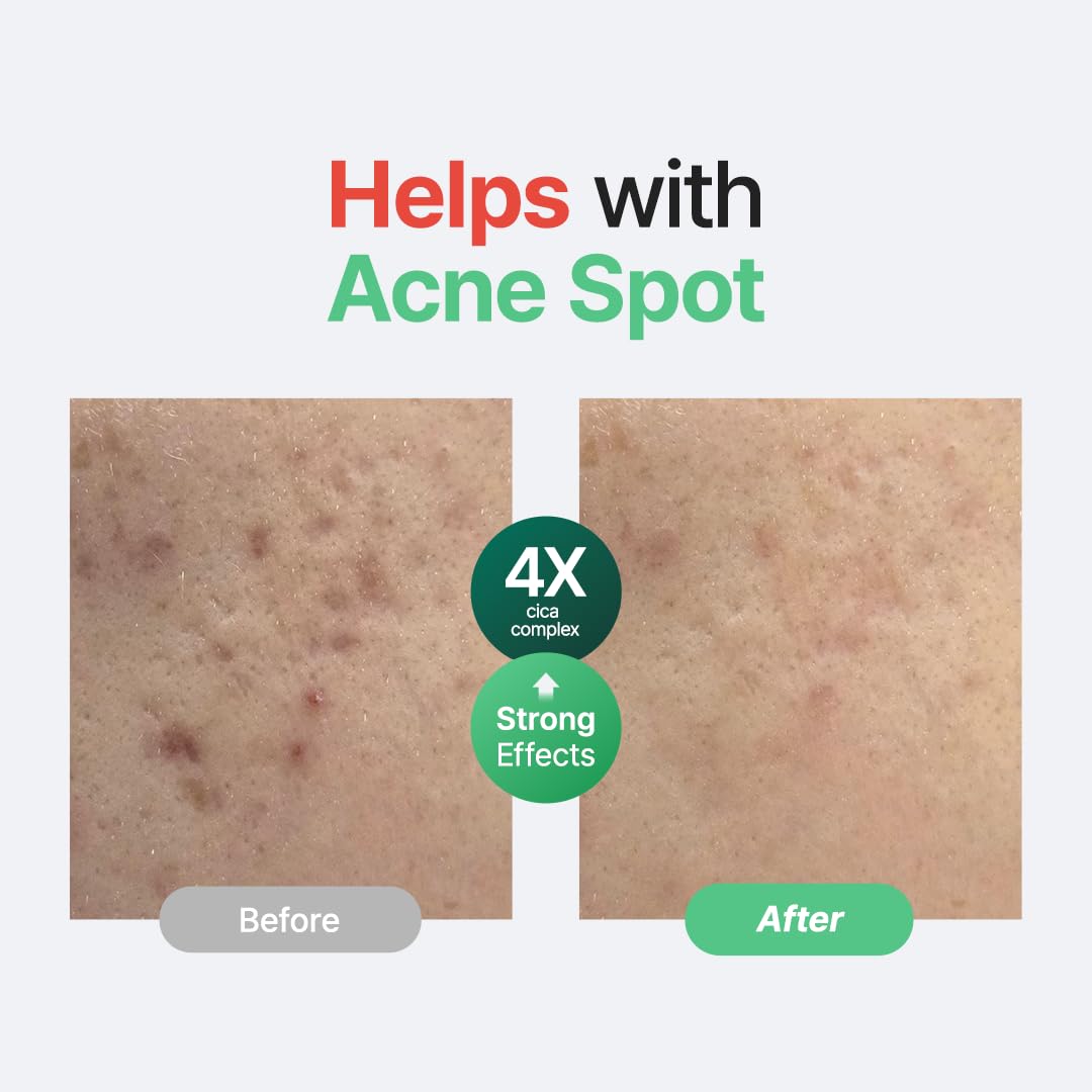 Wonder Releaf Centella Facial Serum