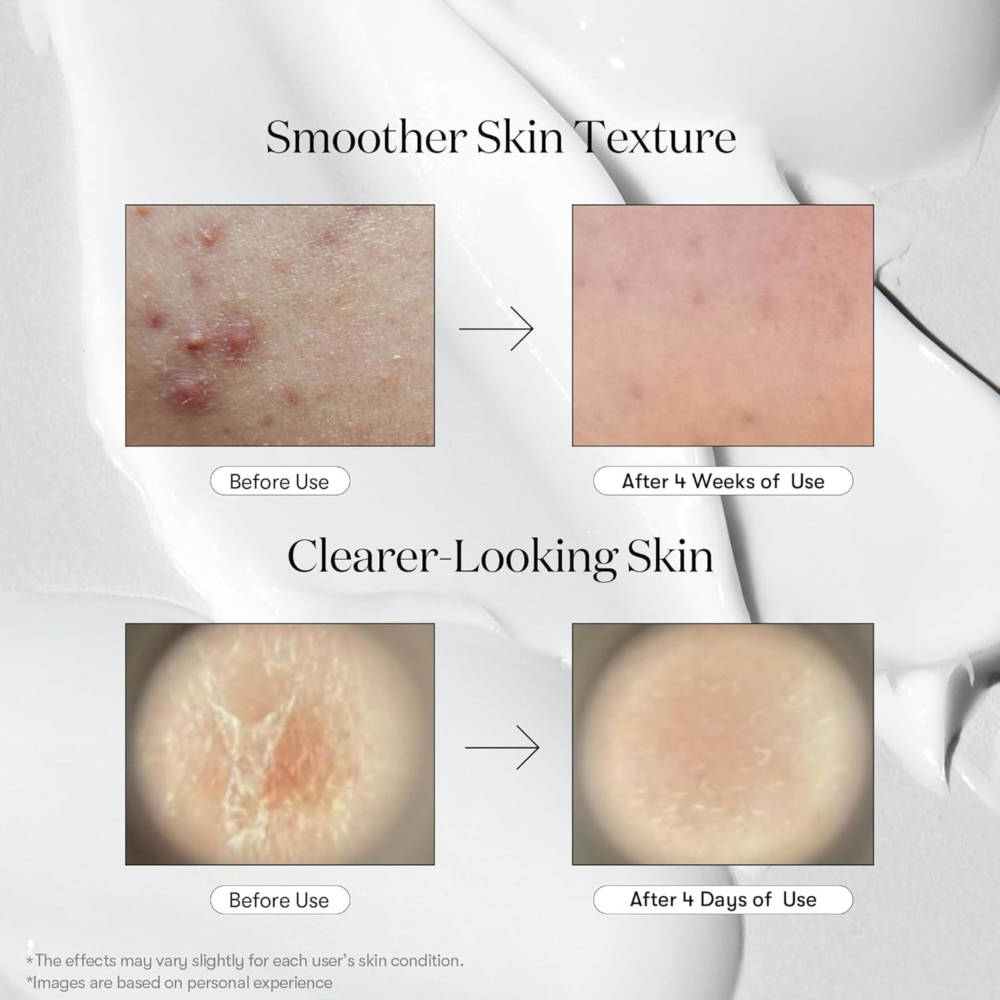 VT COSMETICS Cica Reedle Shot 100